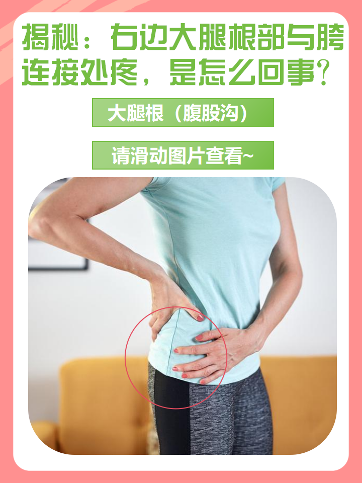 What part is the hip (what part is the hip woman)